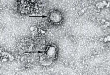 Peneliti: Virus Corona Bisa Bunuh 65 Juta Jiwa dalam 18 Bulan