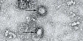 Peneliti: Virus Corona Bisa Bunuh 65 Juta Jiwa dalam 18 Bulan