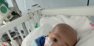 Usai di operasi, kondisi Aliqa Azzahra, bayi jantung bocor terus membaik