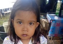 Setelah 5 tahun, bocah pengidap jantung bocor asal Tabunganen Batola berpeluang dioperasi