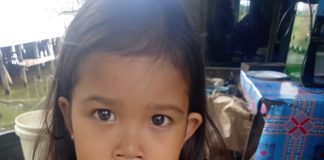 Setelah 5 tahun, bocah pengidap jantung bocor asal Tabunganen Batola berpeluang dioperasi