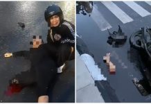 Lakalantas di Simpang 3 Kuripan Banjarmasin, satu kaki pengendara motor putus