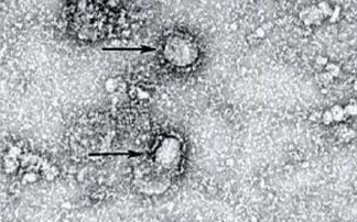 Peneliti: Virus Corona Bisa Bunuh 65 Juta Jiwa dalam 18 Bulan